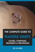 Cover: The Complete Guide to Plantar Warts: Causes, Symptoms, Treatment & Prevention - Dr. W. Ness