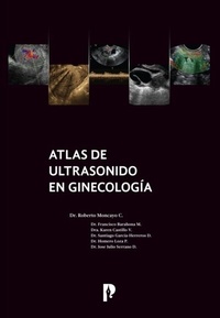 Abbildung von: Atlas de ultrasonido en ginecología - Pontificia Universidad Católica del Ecuador