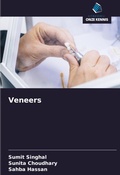 Cover: Veneers - Uitgeverij Onze Kennis