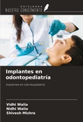 Cover: Implantes en odontopediatr&iacute;a - Ediciones Nuestro Conocimiento