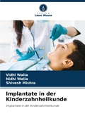 Cover: Implantate in der Kinderzahnheilkunde - Verlag Unser Wissen
