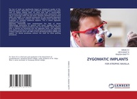 Abbildung von: Zygomatic Implants - LAP Lambert Academic Publishing