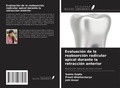 Cover: Evaluaci&oacute;n de la reabsorci&oacute;n radicular apical durante la retracci&oacute;n anterior - Ediciones Nuestro Conocimiento