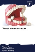 Cover: Uspeh implantacii - Sciencia Scripts