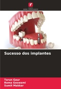Cover: Sucesso dos implantes - Edicoes Nosso Conhecimento