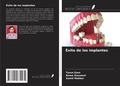 Cover: &Eacute;xito de los implantes - Ediciones Nuestro Conocimiento