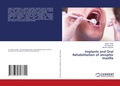 Cover: Implants and Oral Rehabilitation of atrophic maxilla - LAP Lambert Academic Publishing
