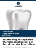 Cover: Beurteilung der apikalen Wurzelresorption bei der Retraktion der Frontzaehne - Verlag Unser Wissen