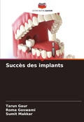 Cover: Succes des implants - Editions Notre Savoir