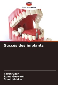 Enlarge image Cover: Succes des implants - Editions Notre Savoir