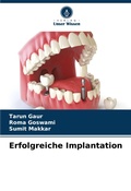 Cover: Erfolgreiche Implantation - Verlag Unser Wissen