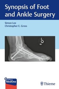 Abbildung von: Synopsis of Foot and Ankle Surgery - Thieme Publishers