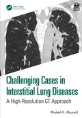 Cover: Challenging Cases in Interstitial Lung Diseases - CRC Press
