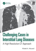 Cover: Challenging Cases in Interstitial Lung Diseases - CRC Press