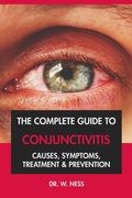 Cover: The Complete Guide to Conjunctivitis: Causes, Symptoms, Treatment & Prevention - Interactive Media Licensing