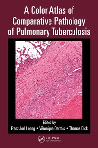 Enlarge image Cover: A Color Atlas of Comparative Pathology of Pulmonary Tuberculosis - CRC Press