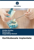Cover: Kortikobasale Implantate - Verlag Unser Wissen