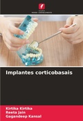 Cover: Implantes corticobasais - Edicoes Nosso Conhecimento