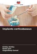 Cover: Implants corticobasaux - Editions Notre Savoir