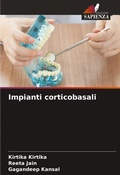 Cover: Impianti corticobasali - Edizioni Sapienza