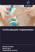 Cover: Corticobasale implantaten - Uitgeverij Onze Kennis