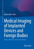 Bild: Medical Imaging of Implanted Devices and Foreign Bodies - Springer