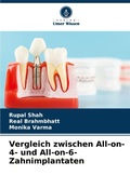 Cover: Vergleich zwischen All-on-4- und All-on-6-Zahnimplantaten - International Book Market Service Ltd