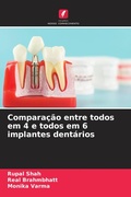 Cover: Comparacao entre todos em 4 e todos em 6 implantes dentarios - International Book Market Service Ltd