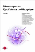 Cover: Erkrankungen von Hypothalamus und Hypophyse - UNI-MED Verlag AG