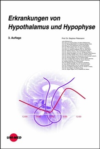 Abbildung von: Erkrankungen von Hypothalamus und Hypophyse - UNI-MED Verlag AG