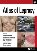 Cover: Atlas of Leprosy - CRC Press