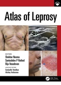 Cover: Atlas of Leprosy - CRC Press