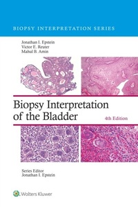 Abbildung von: Biopsy Interpretation of the Bladder - Wolters Kluwer Health