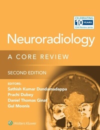 Abbildung von: Neuroradiology - Wolters Kluwer Health