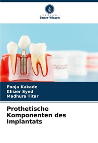Abbildung von: Prothetische Komponenten des Implantats - Verlag Unser Wissen