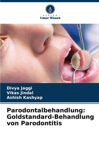 Enlarge image Cover: Parodontalbehandlung - Verlag Unser Wissen