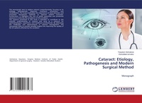 Abbildung von: Cataract - LAP Lambert Academic Publishing