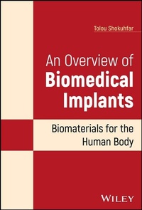 Abbildung von: An Overview of Biomedical Implants - Wiley