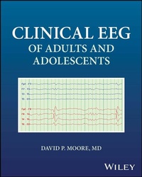 Abbildung von: Clinical EEG of Adults and Adolescents - Wiley