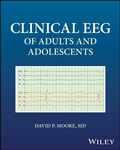 Abbildung von: Clinical EEG of Adults and Adolescents - Wiley-Scrivener