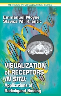 Enlarge image Cover: Visualization of Receptors In Situ - CRC Press