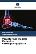 Cover: Vorgeformte mediale Malleolus-Verriegelungsplatte - Verlag Unser Wissen