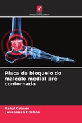 Cover: Placa de bloqueio do maleolo medial pre-contornada - Edicoes Nosso Conhecimento