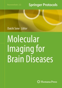 Abbildung von: Molecular Imaging for Brain Diseases - Humana
