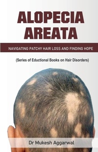 Abbildung von: Alopecia Areata - Notion Press