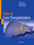 Cover: Atlas of Liver Transplantation - Springer