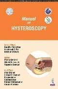 Cover: Manual on Hysteroscopy - Jaypee Brothers Medical Publishers