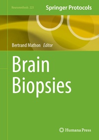 Abbildung von: Brain Biopsies - Humana
