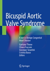 Abbildung von: Bicuspid Aortic Valve Syndrome - Springer