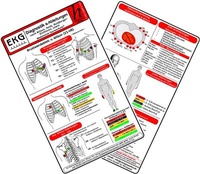 Abbildung von: EKG Diagnostik & Ableitungen 2025 - Medizinische Taschen-Karte - Hawelka, Uwe